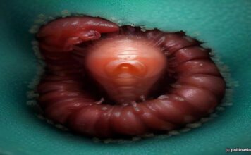 Worms mate in man's eyes, get plucked out right before larvae burst out Worms mate in man's eyes, get plucked out right before larvae burst out